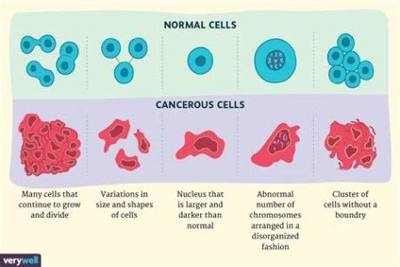 Eye Stones VS Corneal Dystrophy: 2025 Vision